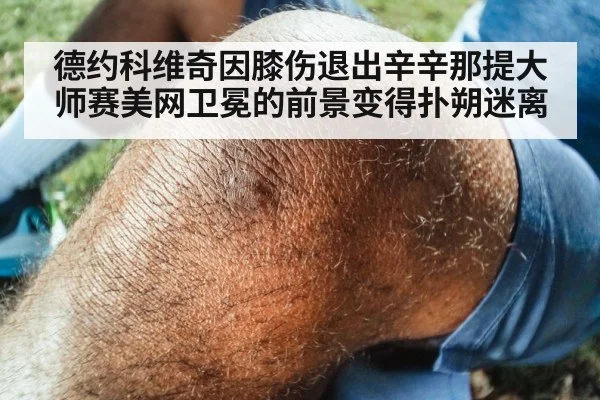 德约科维奇因膝伤退出辛辛那提大师赛美网卫冕的前景变得扑朔迷离